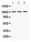 Anti-RASA1 Picoband Antibody