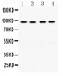 Anti-CD19 Picoband Antibody