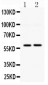 Anti-DGAT1 Picoband Antibody