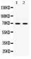 Anti-PKR Picoband Antibody