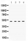 Anti-RRM2 Picoband Antibody