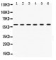 Anti-TCP1 Alpha Picoband Antibody