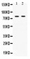 Anti-Transferrin Picoband Antibody