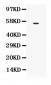 Anti-TGFBR1 Picoband Antibody