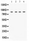 Anti-TGFBR2 Picoband Antibody