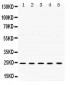 Anti-TIMP-2 Antibody