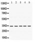 Anti-TIMP-3 Antibody