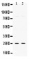 Anti-TK1 Picoband Antibody