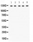 Anti-TRPM8 Picoband Antibody