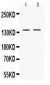 Anti-RENT1/hUPF1 Picoband Antibody