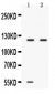 Anti-Ceruloplasmin Picoband Antibody