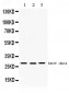 Anti-Cathepsin D Picoband Antibody