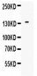 Anti-EGF Picoband Antibody