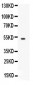 Anti-FCRN/FCGRT Picoband Antibody