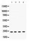 Anti-RAB7 Picoband Antibody