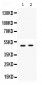 Anti-SFRP4 Picoband Antibody