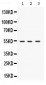 Anti-SPTLC1 Picoband Antibody