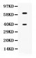 Anti-TPP1 Picoband Antibody