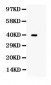 Anti-TRIB2 Picoband Antibody