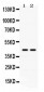 Anti-ADA Picoband Antibody