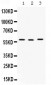 Anti-CAP1 Picoband Antibody