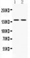 Anti-CASR Picoband Antibody