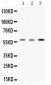 Anti-Catalase Picoband Antibody