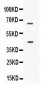 Anti-CD33 Picoband Antibody