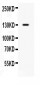 Anti-CDCP1 Picoband Antibody