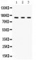 Anti-Factor B Picoband Antibody