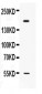 Anti-Collagen I Picoband Antibody