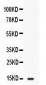 Anti-FABP2/I-FABP Picoband Antibody