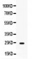 Anti-FGF1 Picoband Antibody