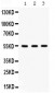 Anti-Integrin linked ILK Picoband Antibody