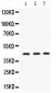 Anti-AGP1/alpha 1 acid glycoprotein Picoband Antibody