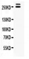 Anti-WNK1 Picoband Antibody