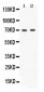 Anti-ZAP70 Picoband Antibody