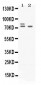 Anti-Plzf Picoband Antibody