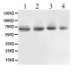 Anti-ABCB10 Picoband Antibody