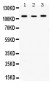 Anti-Alpha Actinin 4 Picoband Antibody