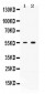 Anti-ACVR2B Picoband Antibody