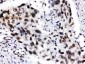 Anti-ADAR1 Picoband Antibody