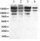 Anti-ADAR1 Picoband Antibody