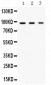 Anti-Ago2/eIF2C2 Picoband Antibody