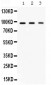 Anti-Ago2/eIF2C2 Picoband Antibody