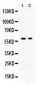 Anti-AIRE Picoband Antibody