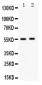 Anti-ALDH3A2 Picoband Antibody