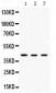 Anti-AMACR Picoband Antibody