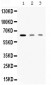 Anti-AMHR2 Picoband Antibody