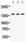 Anti-Bcr Picoband Antibody